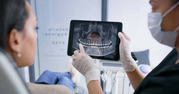 Licensed Tooth Extraction service in St. Petersburg, FL - Smile Center Dentistry